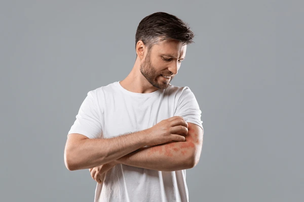 Fenbendazole 500 mg Tablets: Anti-Parasitic Treatment